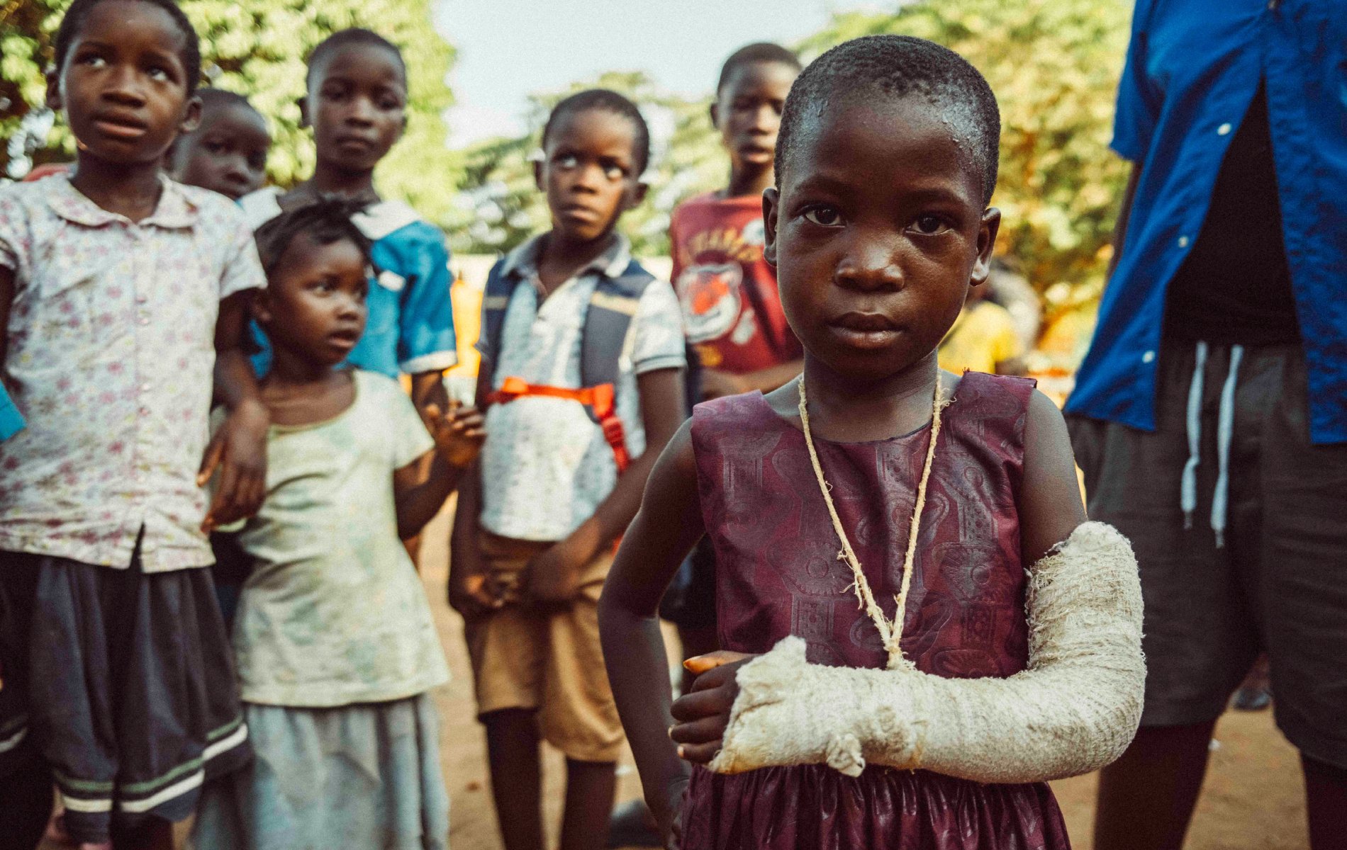 A child with her left arm in a cast, poses with her right hand on her hip.